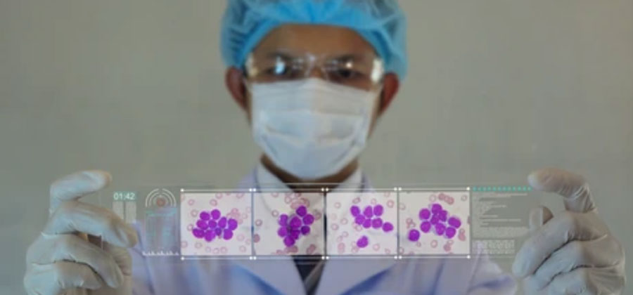 A hematology clinical trial - CLC3