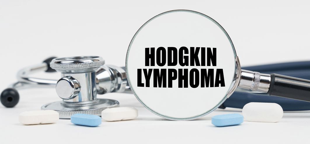 CCTG HD12 a hematology trial investigating targeted therapy for early-stage Hodgkin lymphoma opens in Canada
