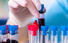 Now open, the SC30 study investigating the role of immunoglobulin