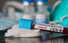 Publication: Primary ICC1COVID-19 in Cancer Patients Study 