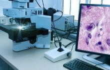 CIHR has announced $3,056,176 in funding over 5 years, for the TACtful trial CIHR has announced $3,056,176 in funding over 5 years, for the TACtful trial