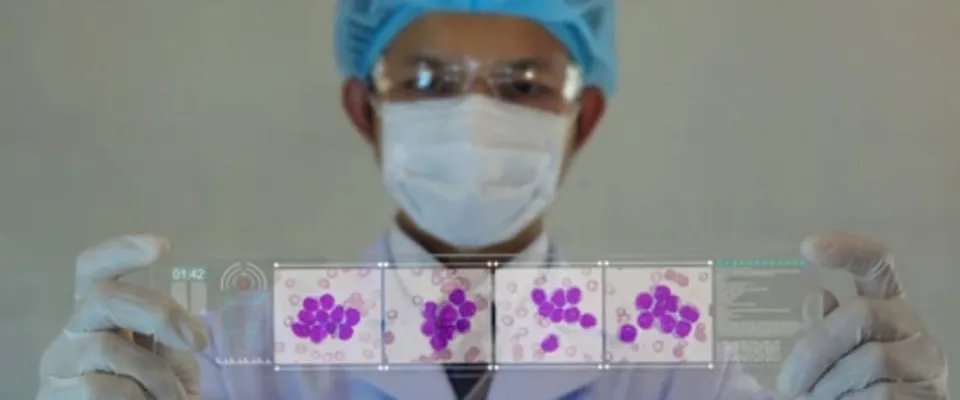 A hematology clinical trial - CLC3