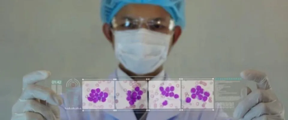 A hematology clinical trial - CLC3