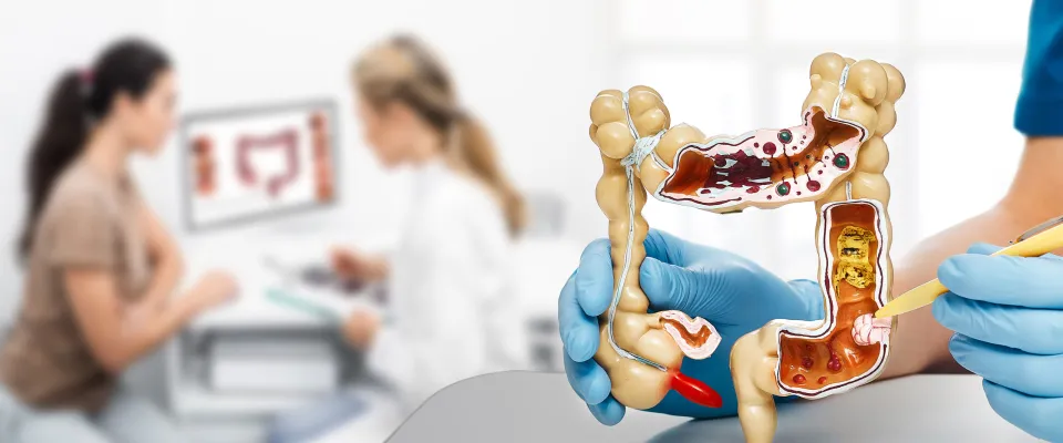 The CRC10 colon cancer trial looks at ctDNA to identify the right treatment after surgery.