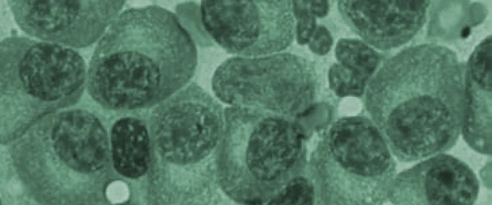  MY13 study multiple myeloma