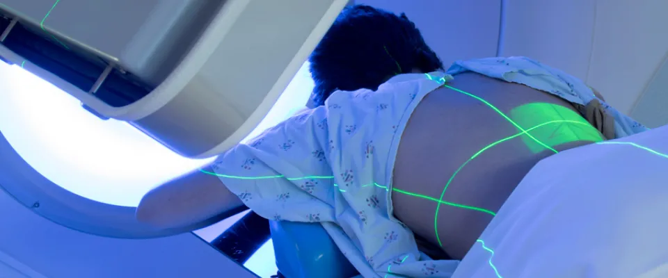 Findings from the SC24 International trial have been published in Lancet Oncology
