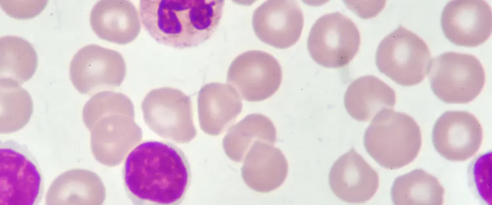 Cell Therapy’s Promise for Canadians Must Include Access