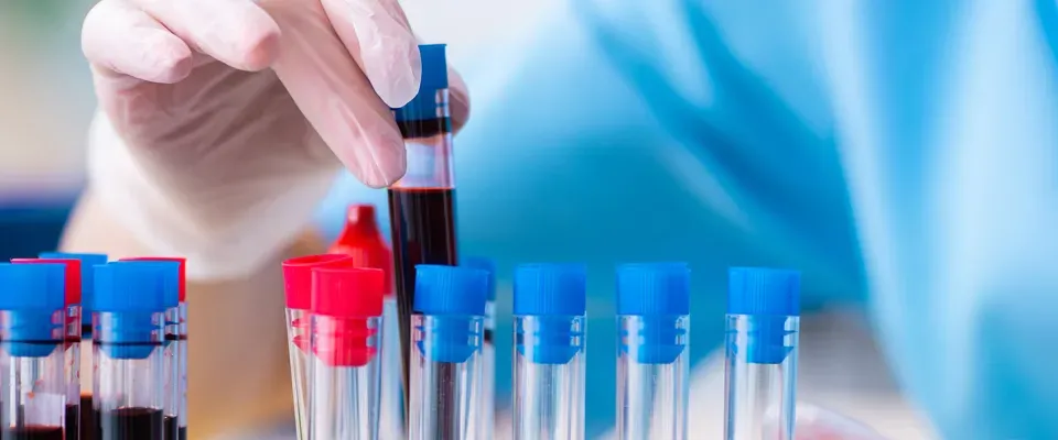 Now open, the SC30 study investigating the role of immunoglobulin and antibiotics on infections in patients with blood cancers